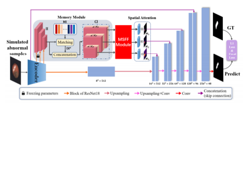PC-Mythic 환경 기반 지폐인식 및 fitness 딥러닝 알고리즘 기초연구